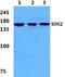 SOS Ras/Rho Guanine Nucleotide Exchange Factor 2 antibody, PA5-75569, Invitrogen Antibodies, Western Blot image 