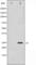 Transketolase antibody, abx012257, Abbexa, Western Blot image 