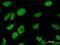 T-Box 18 antibody, H00009096-M06, Novus Biologicals, Immunocytochemistry image 