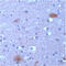 Non-A beta component of AD amyloid antibody, ADI-905-565-1, Enzo Life Sciences, Immunohistochemistry paraffin image 