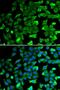 Sirtuin 2 antibody, LS-C335087, Lifespan Biosciences, Immunofluorescence image 