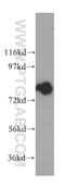 Inositol Polyphosphate-5-Phosphatase B antibody, 15141-1-AP, Proteintech Group, Western Blot image 