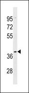 Olfactory Receptor Family 5 Subfamily AK Member 2 antibody, LS-C158490, Lifespan Biosciences, Western Blot image 