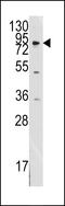 Discoidin Domain Receptor Tyrosine Kinase 1 antibody, LS-C97571, Lifespan Biosciences, Western Blot image 