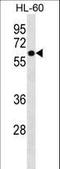 Zinc Finger Protein 649 antibody, LS-C160927, Lifespan Biosciences, Western Blot image 