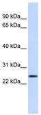 Proline Rich And Gla Domain 1 antibody, TA335271, Origene, Western Blot image 