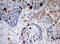 DNA Topoisomerase II Alpha antibody, LS-C336543, Lifespan Biosciences, Immunohistochemistry paraffin image 