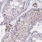 Protein Arginine Methyltransferase 6 antibody, NBP2-32459, Novus Biologicals, Immunohistochemistry paraffin image 
