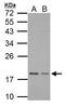 Trafficking Protein Particle Complex 3 antibody, GTX121338, GeneTex, Western Blot image 