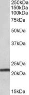 Transmembrane Protein 205 antibody, PA5-19405, Invitrogen Antibodies, Western Blot image 