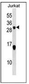 Stathmin 2 antibody, AP54079PU-N, Origene, Western Blot image 