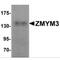 Zinc Finger MYM-Type Containing 3 antibody, MBS151031, MyBioSource, Western Blot image 