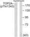 DNA Topoisomerase II Alpha antibody, LS-C199676, Lifespan Biosciences, Western Blot image 
