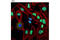 DEAD-Box Helicase 5 antibody, 9877T, Cell Signaling Technology, Immunofluorescence image 