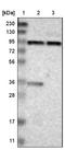 Membrane Integral NOTCH2 Associated Receptor 1 antibody, NBP1-90947, Novus Biologicals, Immunohistochemistry frozen image 