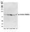 C2CD2 Like antibody, A304-764A, Bethyl Labs, Western Blot image 