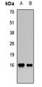 Phospholipase A2 Group IIA antibody, orb411969, Biorbyt, Western Blot image 