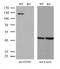 Fibroblast Growth Factor Receptor 3 antibody, M00200-2, Boster Biological Technology, Western Blot image 