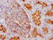 Membrane Metalloendopeptidase antibody, CSB-RA187479A0HU, Cusabio, Immunohistochemistry paraffin image 
