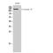 Adenylate Cyclase 4 antibody, LS-C381816, Lifespan Biosciences, Western Blot image 