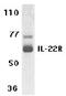 Interleukin 22 Receptor Subunit Alpha 1 antibody, ab5984, Abcam, Western Blot image 