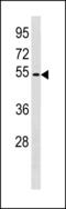Zinc Finger Protein 577 antibody, LS-C203874, Lifespan Biosciences, Western Blot image 