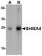 Shisa Family Member 4 antibody, A16391, Boster Biological Technology, Western Blot image 