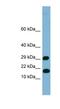 Trafficking Protein Particle Complex 2 Like antibody, NBP1-70735, Novus Biologicals, Western Blot image 