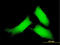 Calcium/Calmodulin Dependent Protein Kinase II Delta antibody, LS-C196811, Lifespan Biosciences, Immunofluorescence image 