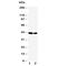 Fms Related Tyrosine Kinase 3 Ligand antibody, R31014, NSJ Bioreagents, Western Blot image 