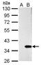 Galectin 4 antibody, GTX125898, GeneTex, Western Blot image 