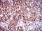 Interleukin 3 Receptor Subunit Alpha antibody, NBP2-37354, Novus Biologicals, Immunohistochemistry paraffin image 