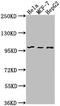 Eukaryotic Translation Initiation Factor 4 Gamma 2 antibody, CSB-PA007569LA01HU, Cusabio, Western Blot image 