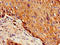 Interleukin 7 Receptor antibody, LS-C682205, Lifespan Biosciences, Immunohistochemistry paraffin image 