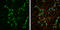 Neurofilament Light antibody, GTX101142, GeneTex, Immunocytochemistry image 