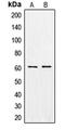 Chondroitin sulfate N-acetylgalactosaminyltransferase 1 antibody, GTX55962, GeneTex, Western Blot image 