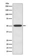 Endothelin Receptor Type B antibody, M01041, Boster Biological Technology, Western Blot image 