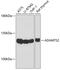 ADAM Metallopeptidase With Thrombospondin Type 1 Motif 2 antibody, 13-548, ProSci, Western Blot image 