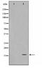 Fragile Histidine Triad Diadenosine Triphosphatase antibody, TA347696, Origene, Western Blot image 