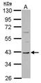 Transmembrane Protein 59 Like antibody, GTX122614, GeneTex, Western Blot image 