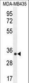 AlkB Homolog 6 antibody, LS-C156284, Lifespan Biosciences, Western Blot image 