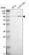 Transcription initiation factor TFIID subunit 5 antibody, PA5-52266, Invitrogen Antibodies, Western Blot image 