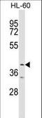 Ankyrin Repeat And BTB Domain Containing 1 antibody, LS-C160990, Lifespan Biosciences, Western Blot image 