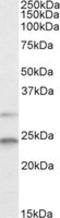 HsMAD2 antibody, TA305640, Origene, Western Blot image 