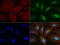 RNA Transcription, Translation And Transport Factor antibody, LS-C796908, Lifespan Biosciences, Immunofluorescence image 