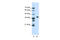 Poly(RC) Binding Protein 1 antibody, 29-366, ProSci, Enzyme Linked Immunosorbent Assay image 