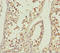 ATP Binding Cassette Subfamily B Member 8 antibody, LS-C675350, Lifespan Biosciences, Immunohistochemistry paraffin image 