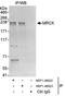 CDC42 Binding Protein Kinase Alpha antibody, NBP1-46822, Novus Biologicals, Immunoprecipitation image 