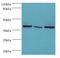 Eukaryotic Translation Initiation Factor 3 Subunit H antibody, MBS1493423, MyBioSource, Western Blot image 