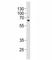 Sequestosome 1 antibody, F52989-0.4ML, NSJ Bioreagents, Western Blot image 